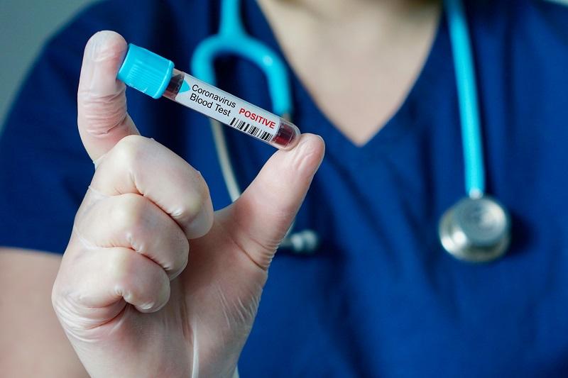 Ημαθία: Λιγότερα από 100 τα νέα θετικά δείγματα κορονοϊού
