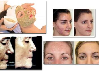 Φυτοπίλιγκ GREEN PEEL: Ένα πολύτιμο δώρο της Μητέρας Φύσης για το δέρμα μας