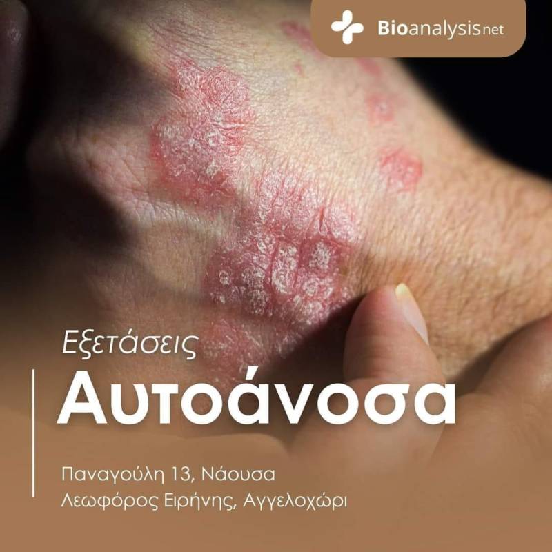 Διάγνωση αυτοάνοσων νοσημάτων